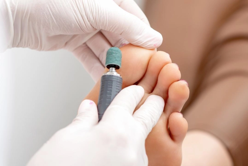 обработка трещин-fullscreen-mobile.webp