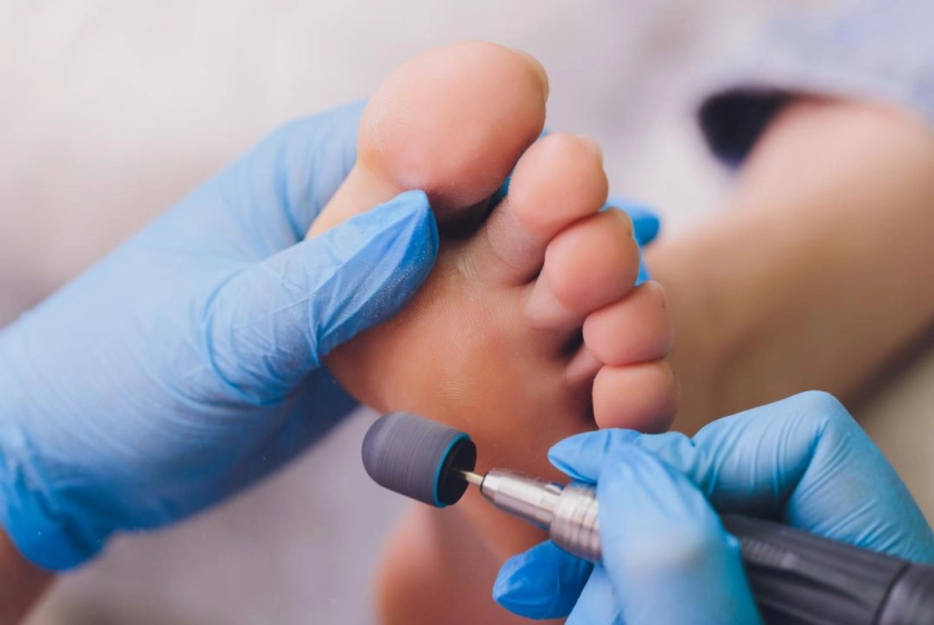 обработка стоп-fullscreen-mobile.webp обработка стоп-fullscreen-mobile.webp